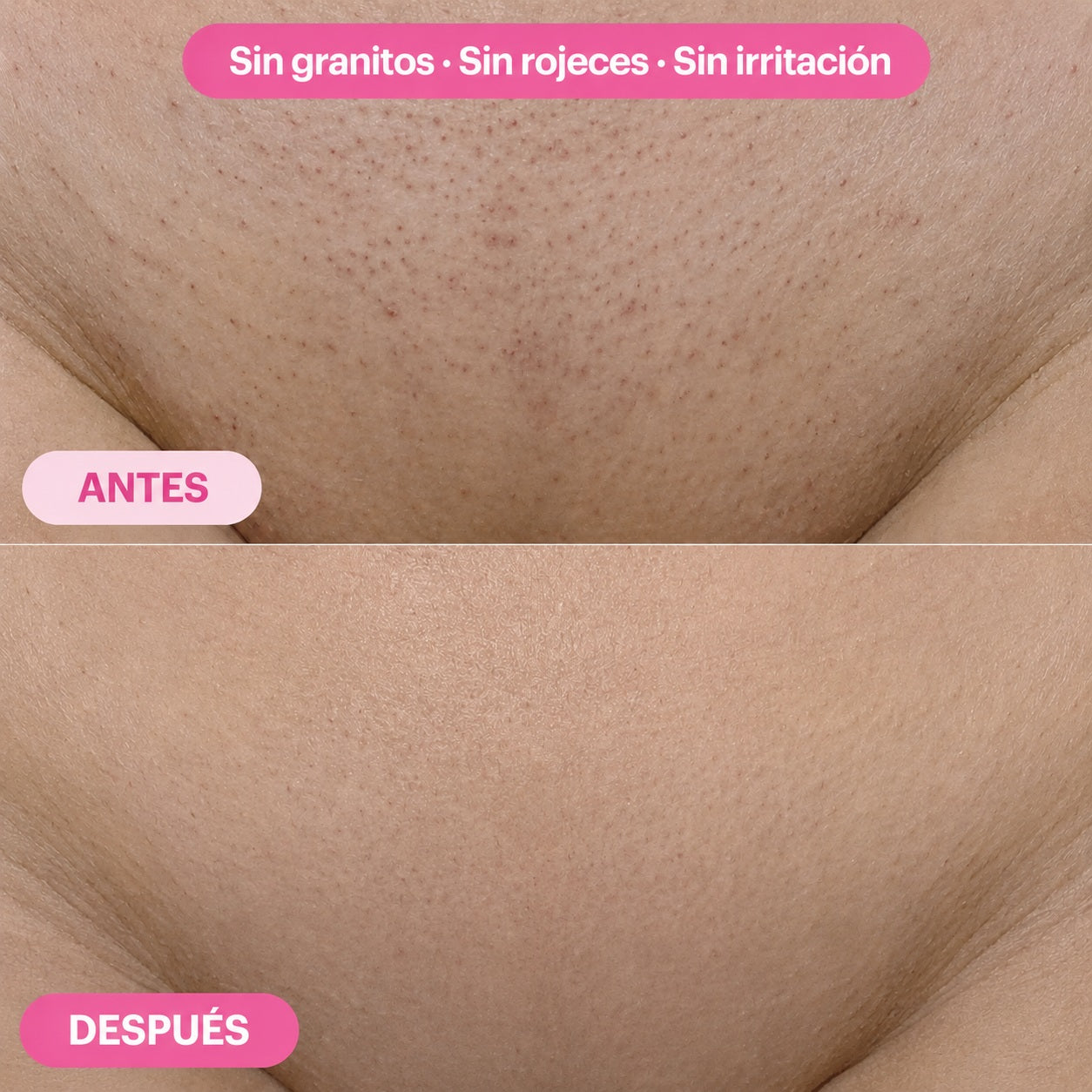 Aceite para una piel suave y sin vello