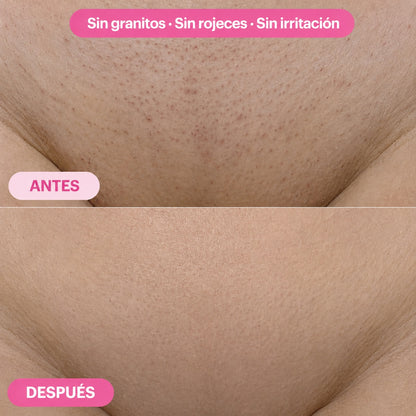 Aceite para una piel suave y sin vello