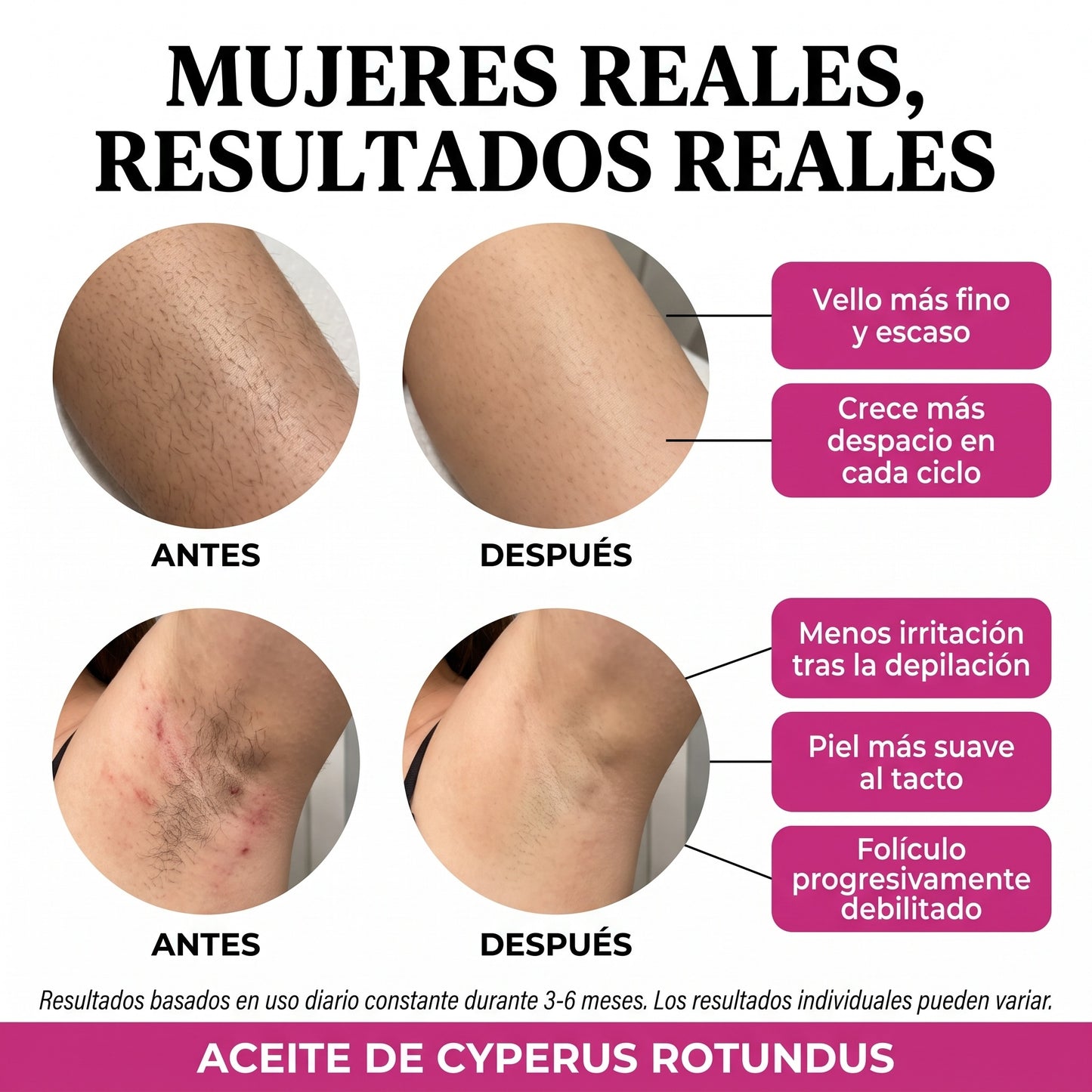 Aceite para una piel suave y sin vello