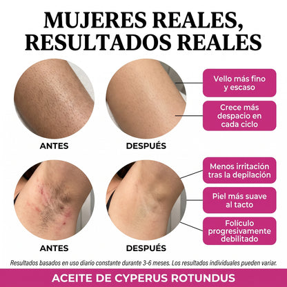 Aceite para una piel suave y sin vello